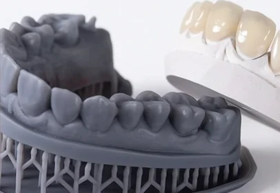 Modelos dentários detalhados em contraste